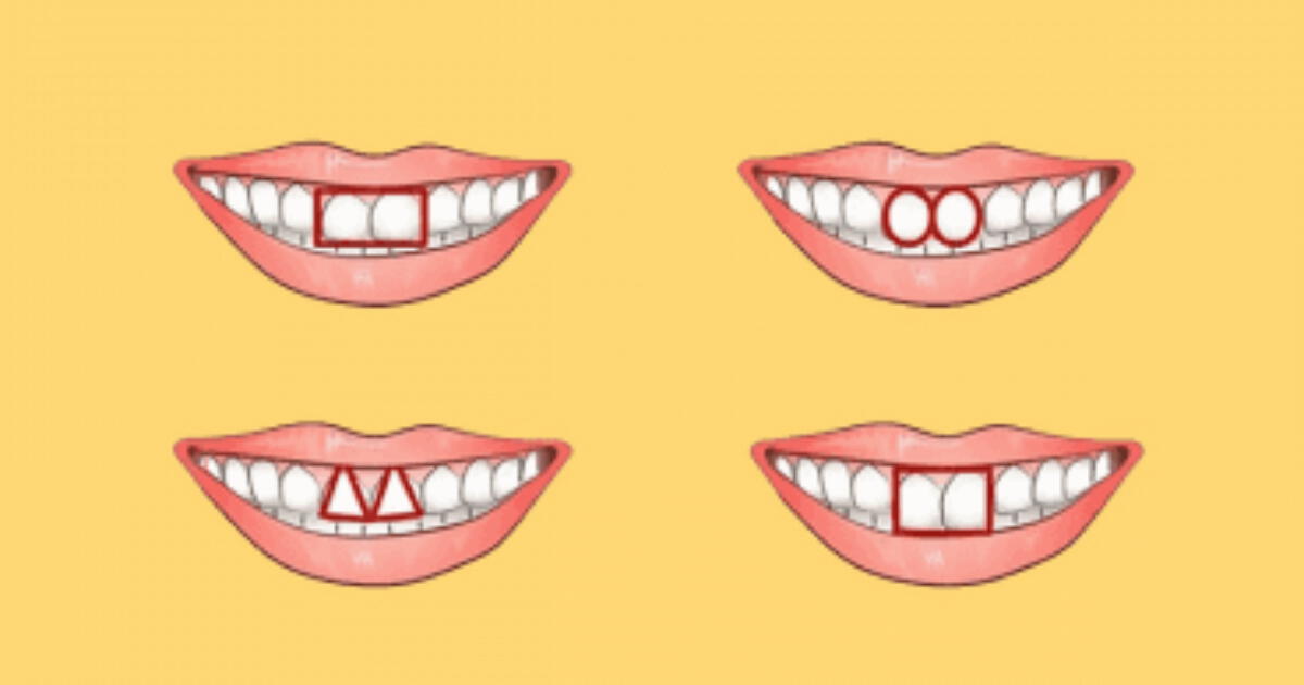 The shape of your teeth says a lot about your character: What does your smile mean?