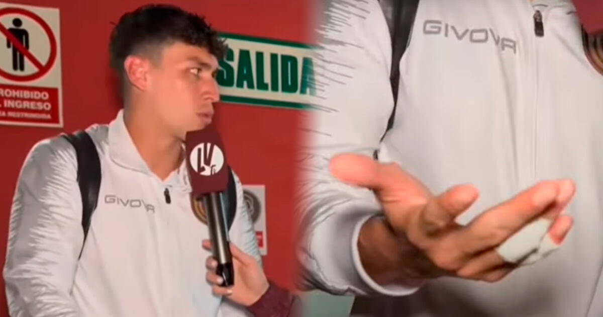 Futbolista venezolano mostró cómo terminaron sus dedos tras enfrentamiento con la Policía