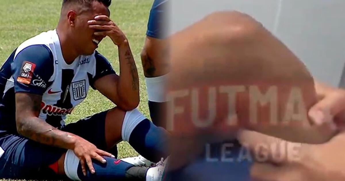 Así quedó la rodilla de Christian Cueva tras jugar lesionado parte del 2023 en Alianza Lima