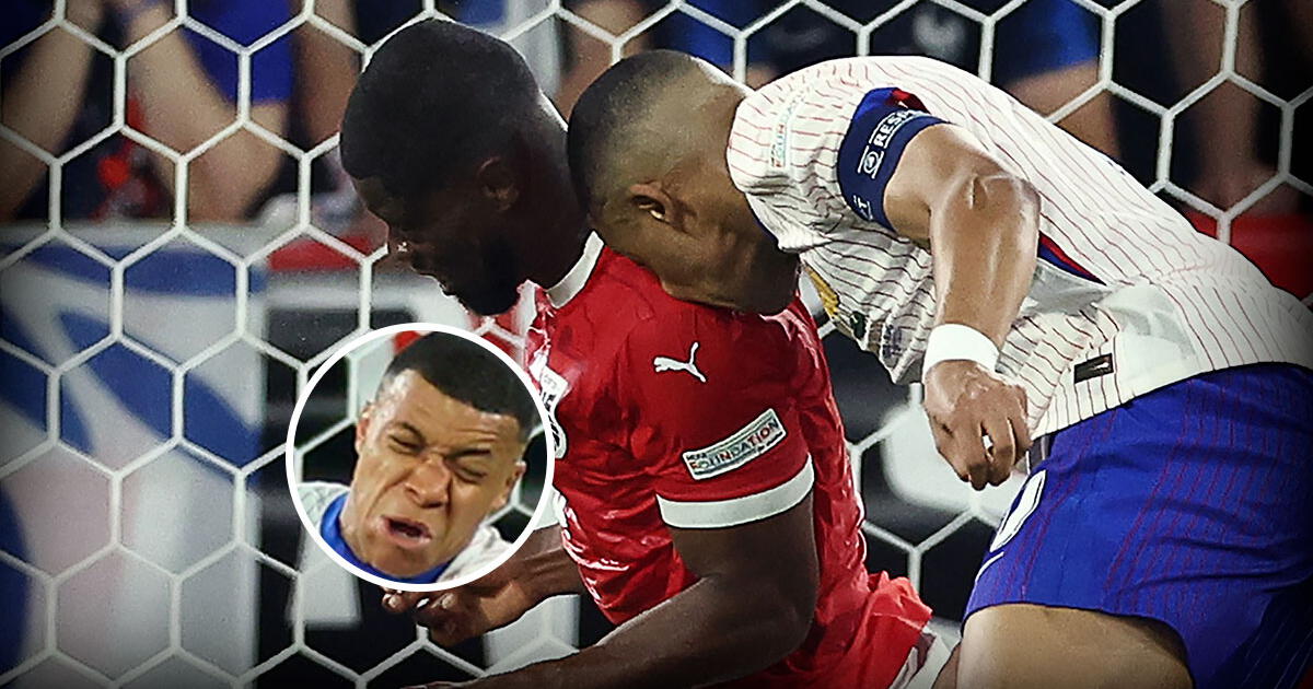 Así quedó la nariz de Mbappé tras duro golpe en el Francia vs. Austria por Eurocopa 2024