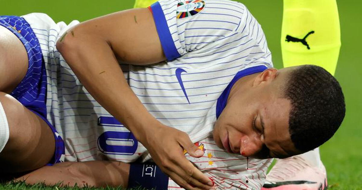 Kylian Mbappé será operado por fractura de nariz y podría ser baja en la Eurocopa 2024