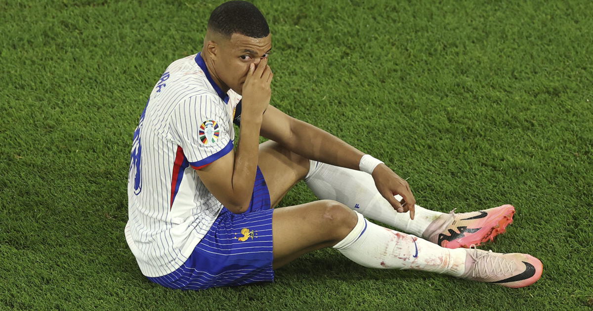 Kylian Mbappé se ROMPIÓ la nariz con Francia en la Eurocopa, pero no será operado