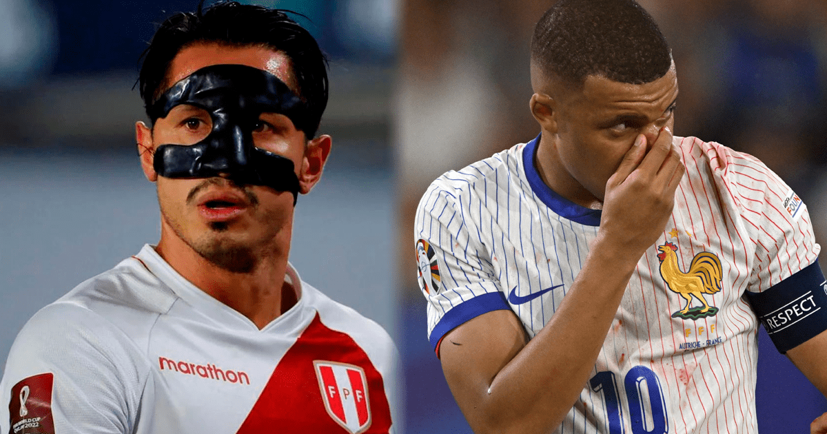 Al estilo Lapadula: Kylian Mbappé usará una máscara en lo que resta de la Eurocopa