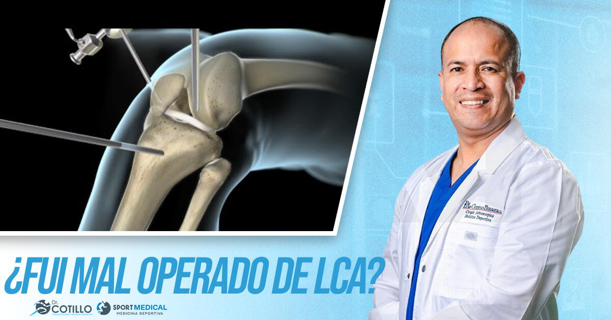 ¿Cómo saber si fui mal operado de Ligamento Cruzado Anterior (LCA)?, por el Dr. Luis Cotillo