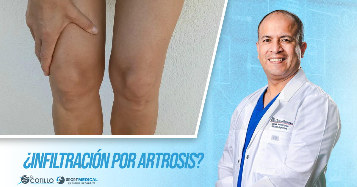 ¿Es bueno infiltrarse si se padece de artrosis a la rodilla?, por el Dr. Luis Cotillo