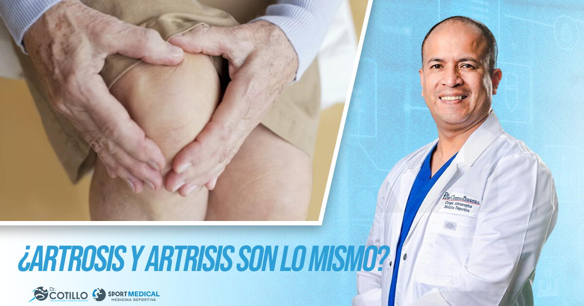 ¿Artrosis y artritis es lo mismo?, por el Dr. Luis Cotillo