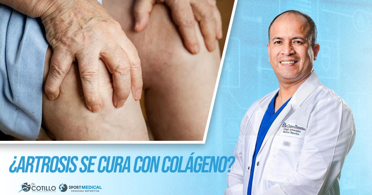 ¿Tienes artrosis y te dijeron que con colágeno te vas a curar?, LA VERDAD por el Dr. Luis Cotillo