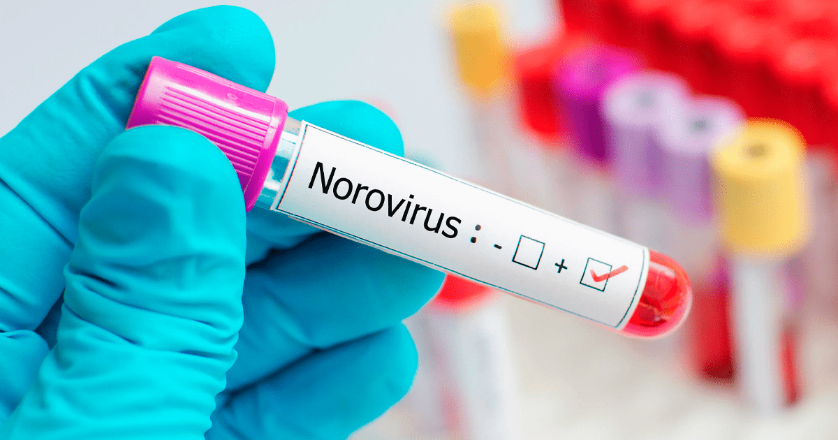 ¡ALERTA en Estados Unidos! Norovirus regresa con fuerza y genera preocupación por aumento de casos