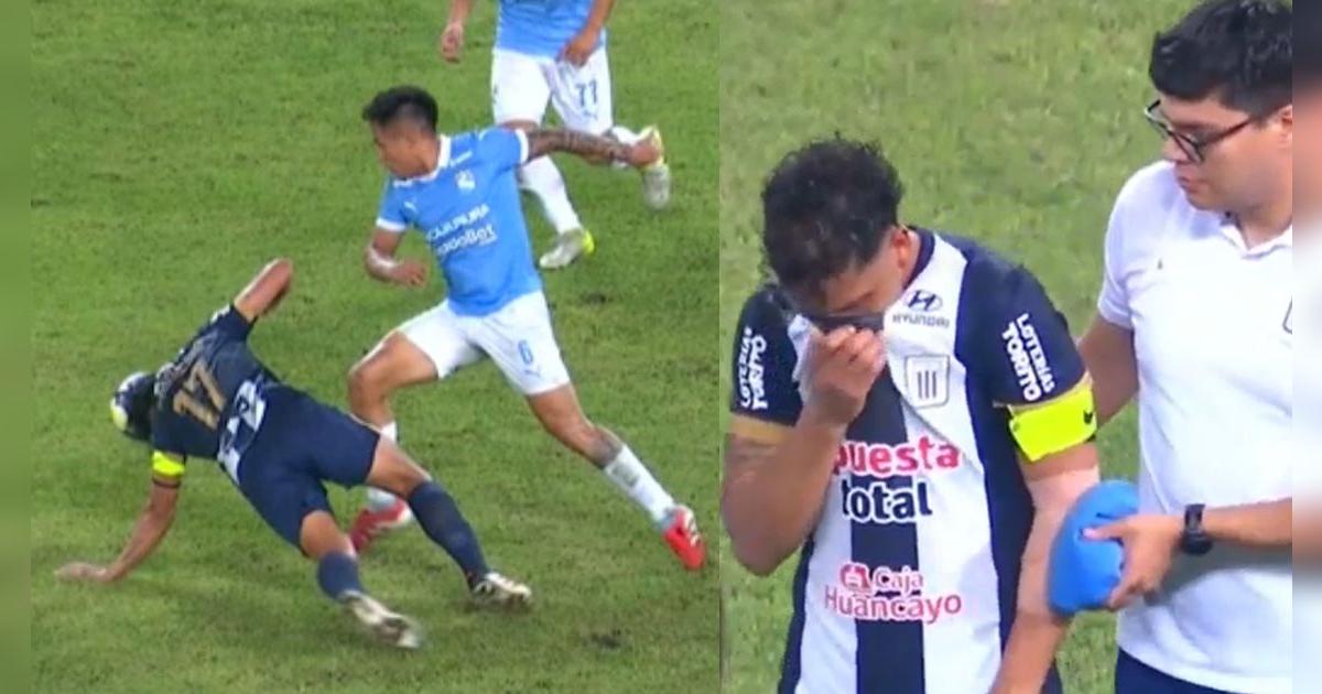 La impactante lesión que sufrió Archimbaud en el Alianza vs. Cristal: 