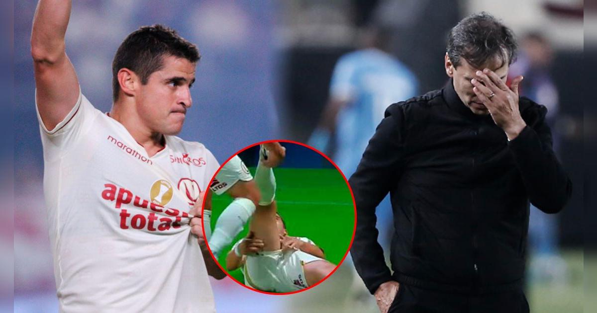 Fabián Bustos dejó alarmante declaración sobre lesión de Aldo Corzo ante IDV: 