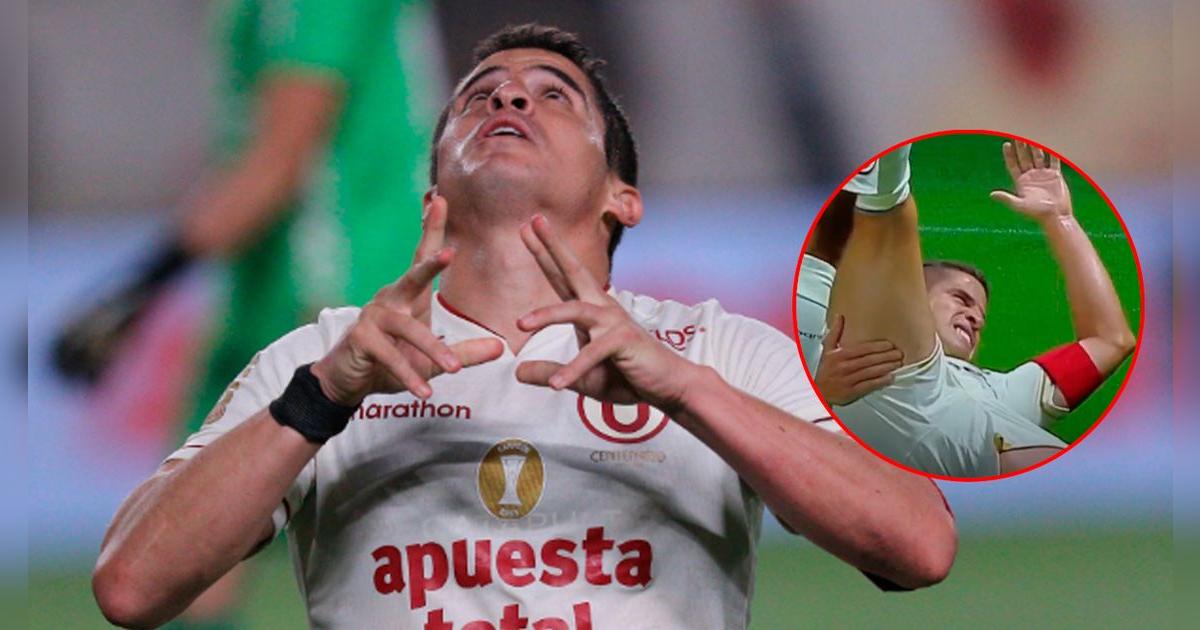 ¿Alarma? Aldo Corzo respondió sobre lesión que sufrió con Universitario: 