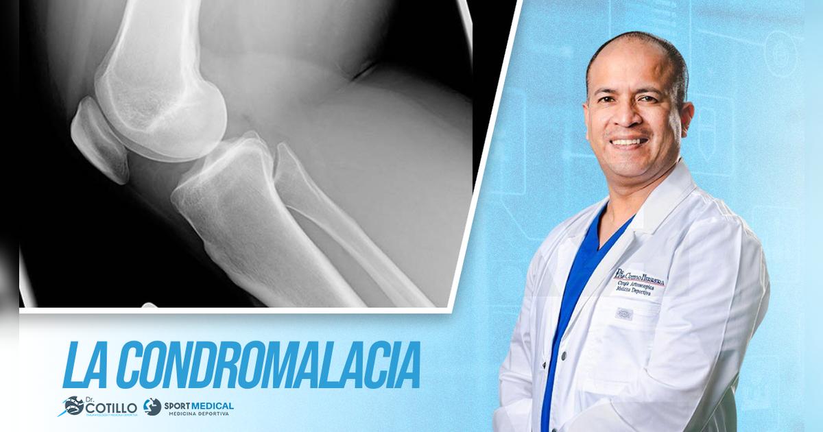 ¿La condromalacia puede ser diagnosticada por un fisioterapeuta?, por el Dr. Luis Cotillo
