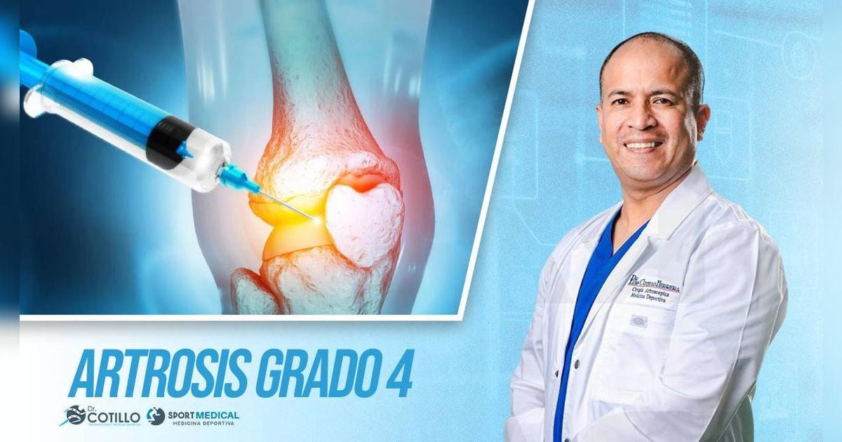 Es falso que el ácido hialurónico sea bueno para la artrosis grado 4, por el Dr. Cotillo