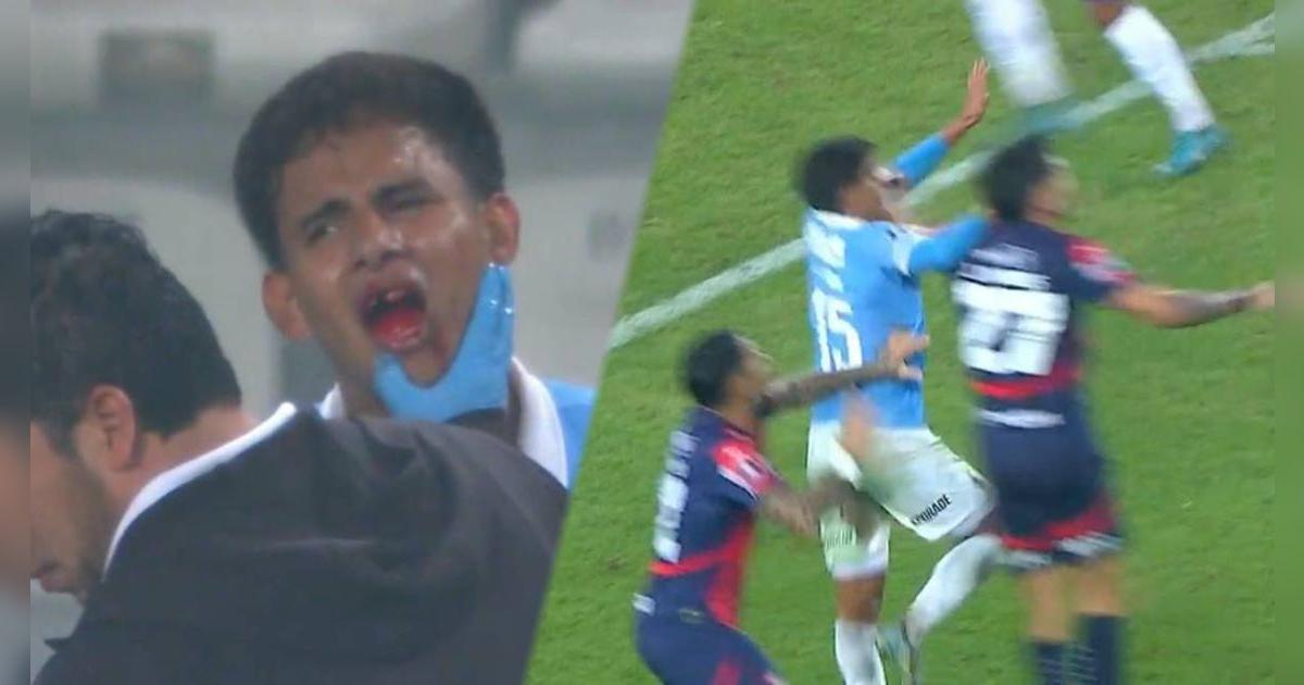 ¡Escandaloso! Jhilmar Lora perdió un diente tras fuerte choque con futbolista de Cerro 