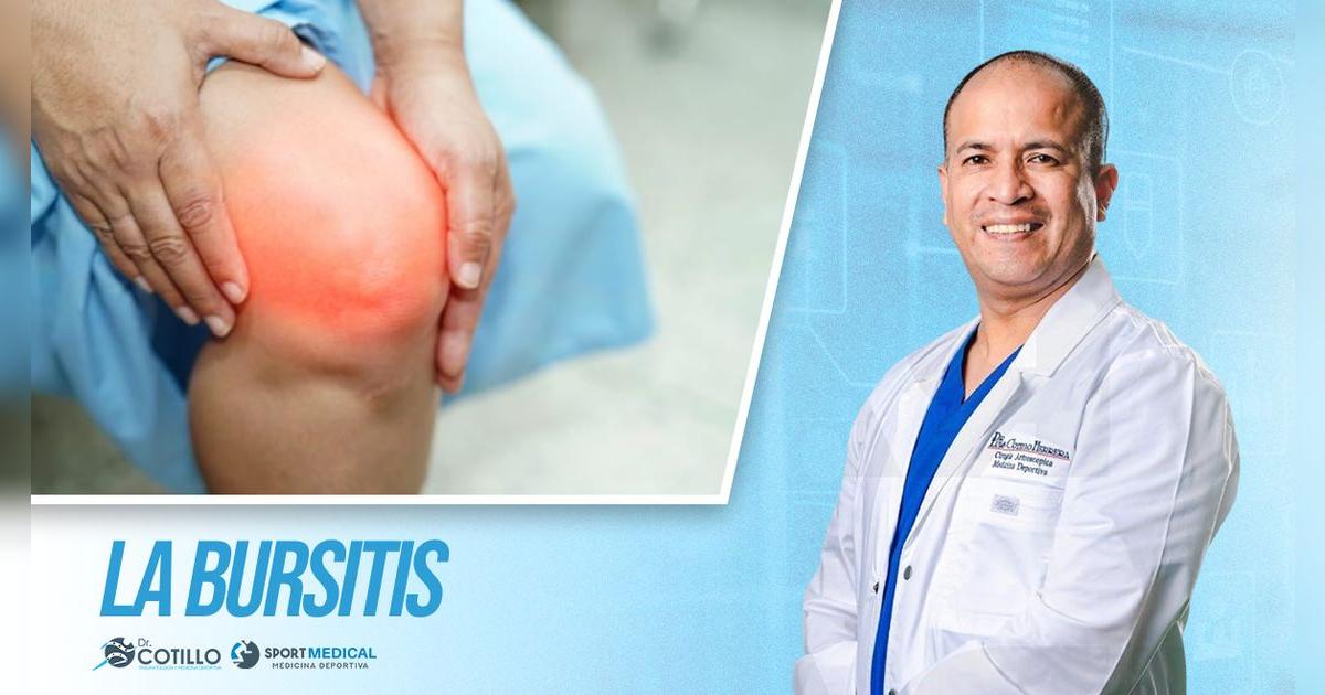 ¿Qué es la bursitis y cómo identificar?, por el Dr. Luis Cotillo