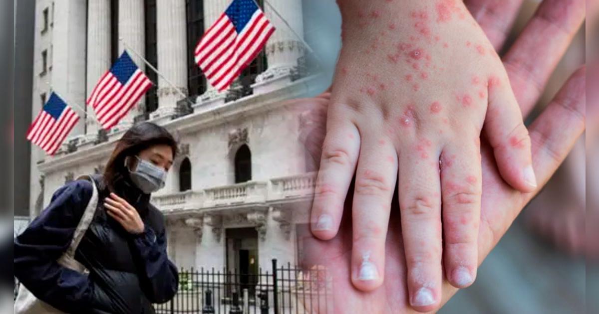 Estados Unidos vive su peor EPIDEMIA de sarampión en más de 30 años, revela universidad