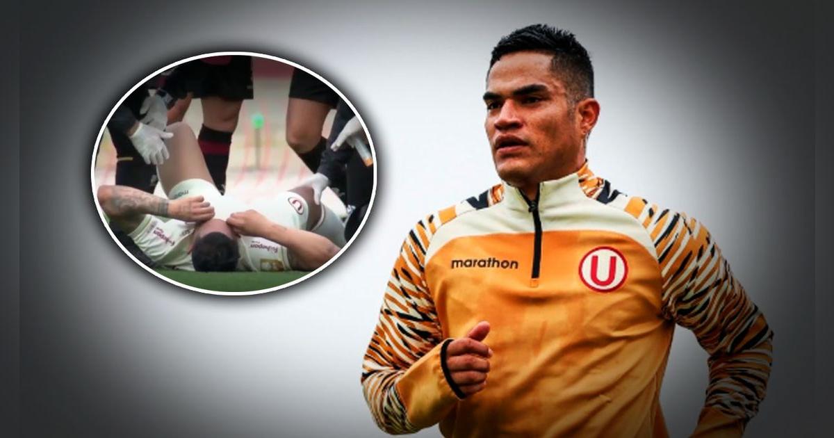 Malas noticias para Universitario: se reveló la fuerte lesión que sufrió Anderson Santamaría