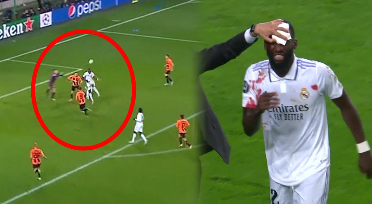 Lleno de sangre: Gol de Rüdiger para anotar el 1-1 entre Real Madrid y Shakhtar 