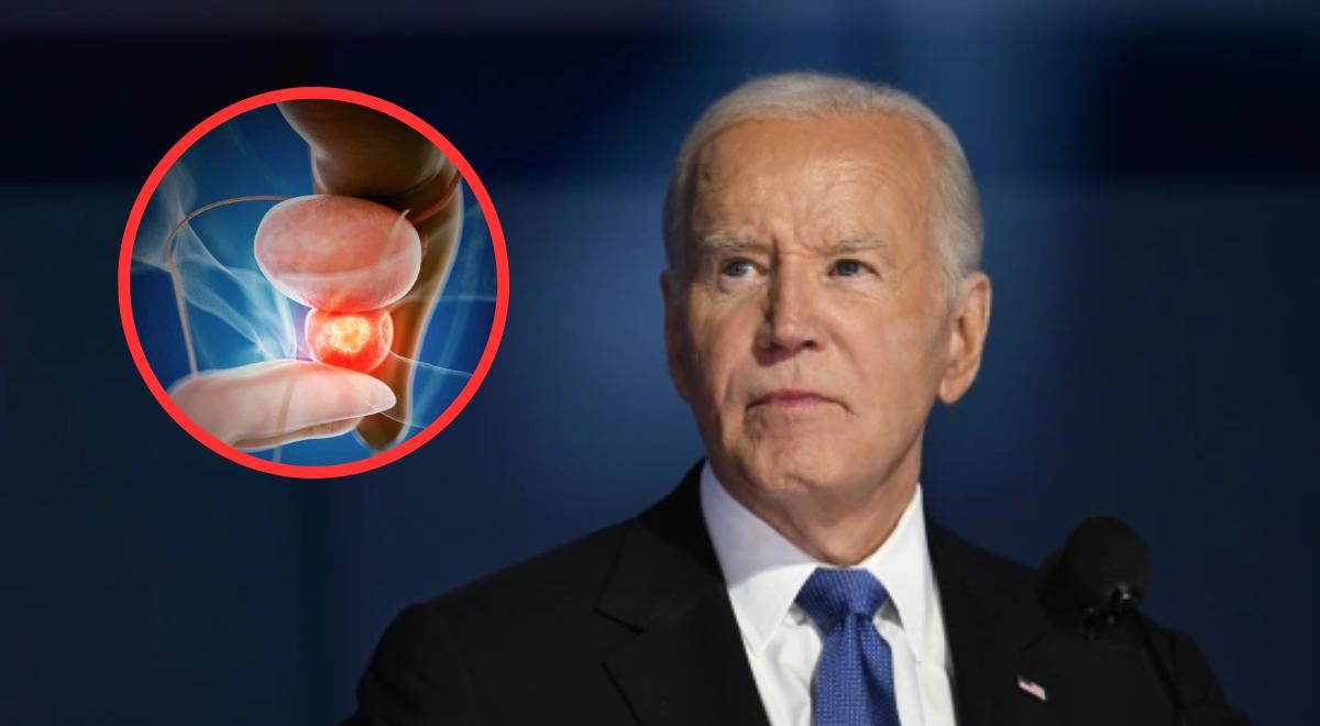 Joe Biden ENFRENTARÁ cinco semanas de radioterapia tras diagnóstico de cáncer de próstata