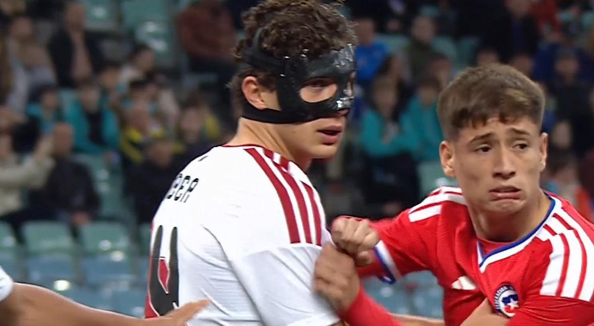 ¿Por qué Fabio Gruber jugó con una máscara en el clásico Perú vs. Chile?