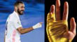 Karim Benzema utiliza un vendaje muy peculiar en su mano derecha. Entérate cuál es la razón de dicho distintivo.