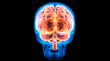 Descubre que sucede con tu cerebro antes de fallecer, según estudio de la Universidad de Michigan
