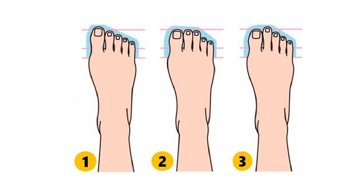 ¿Cómo son tus pies? Elige la forma que más se asemeje y sorpréndete con
