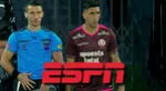 En transmisión de partido de Universitario cometieron un error con Dorregaray.