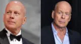 Bruce Willis padece de demencia frontal: ¿Qué es esta enfermedad?