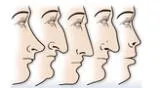 La forma de tu nariz revelará el tipo de personalidad que tienes. ¿Quieres saber cuál es?