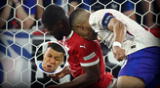 Mbappé abandonó la cancha por golpe en la nariz.