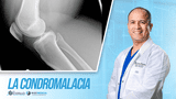 ¿La condromalacia puede ser diagnosticada por un fisioterapeuta? ¿La condromalacia puede ser diagnosticada por un fisioterapeuta?