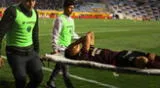 ¡Alerta en Universitario! Jugador recibió fuerte golpe en práctica y será sometido a exámenes ¡Alerta en Universitario! Jugador recibió fuerte golpe en práctica y será sometido a exámenes