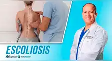 ¿Que es la escoliosis?, por el Dr. Cotillo