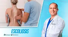 ¿Que es la escoliosis?, por el Dr. Cotillo