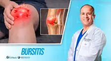 ¿Qué es la bursitis?, por el Dr. Cotillo
