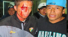 Copa Perú: FPF inicia investigación por agresión a Martín Dall’Orso 