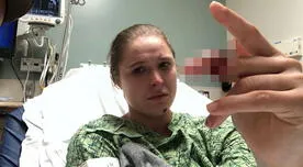 De terror: Ronda Rousey sufrió un terrible accidente y casi pierde uno de sus dedos [FOTO]