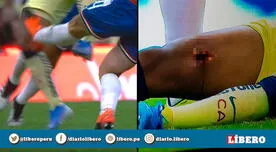 América vs Chivas: La espeluznante lesión que sufrió Gio Dos Santos tras planchazo