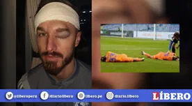Futbolista del Cardiff City muestra gigantesco hematoma que le causó compañero en la Championship