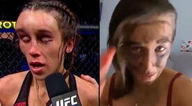 UFC: Joanna Jedrzejczyk y cómo quedó su rostro tras una semana de su pelea [VIDEO]