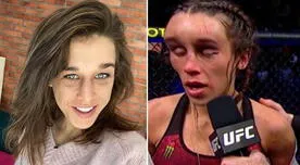 UFC: Así quedo el rostro de Joanna Jedrzejczyk tras un mes de su pelea en UFC 248
