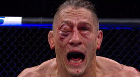  ¡Terrible! Así quedó el ojo de Niko Price tras recibir tremendo golpe en el rostro durante el UFC 249 [VIDEO]