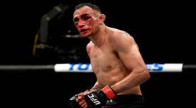 ‘Cucuy’ Ferguson fue hospitalizado tras recibir paliza de Justin Gaethje en el UFC 249