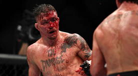 UFC: Darren Elkins terminó con el rostro desfigurado tras su pelea con Landwehr  [VIDEO]