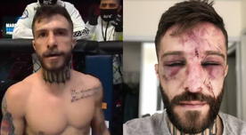 UFC: Así quedó el rostro de Marcelo Rojo tras su debut en el octágono - FOTO