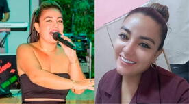 Yuliana Perea de Iquitos: ¿Quién era la cantante de cumbia que falleció tras liposucción?