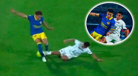 Jugador de América mostró dura imagen de cómo quedó su pierna tras falta de Piero Quispe