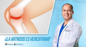 "¿La artrosis es hereditaria?", por el Dr. Luis Cotillo