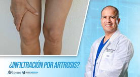 ¿Es bueno infiltrarse si se padece de artrosis a la rodilla?, por el Dr. Luis Cotillo